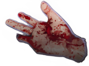 Quest Severed Hand.png